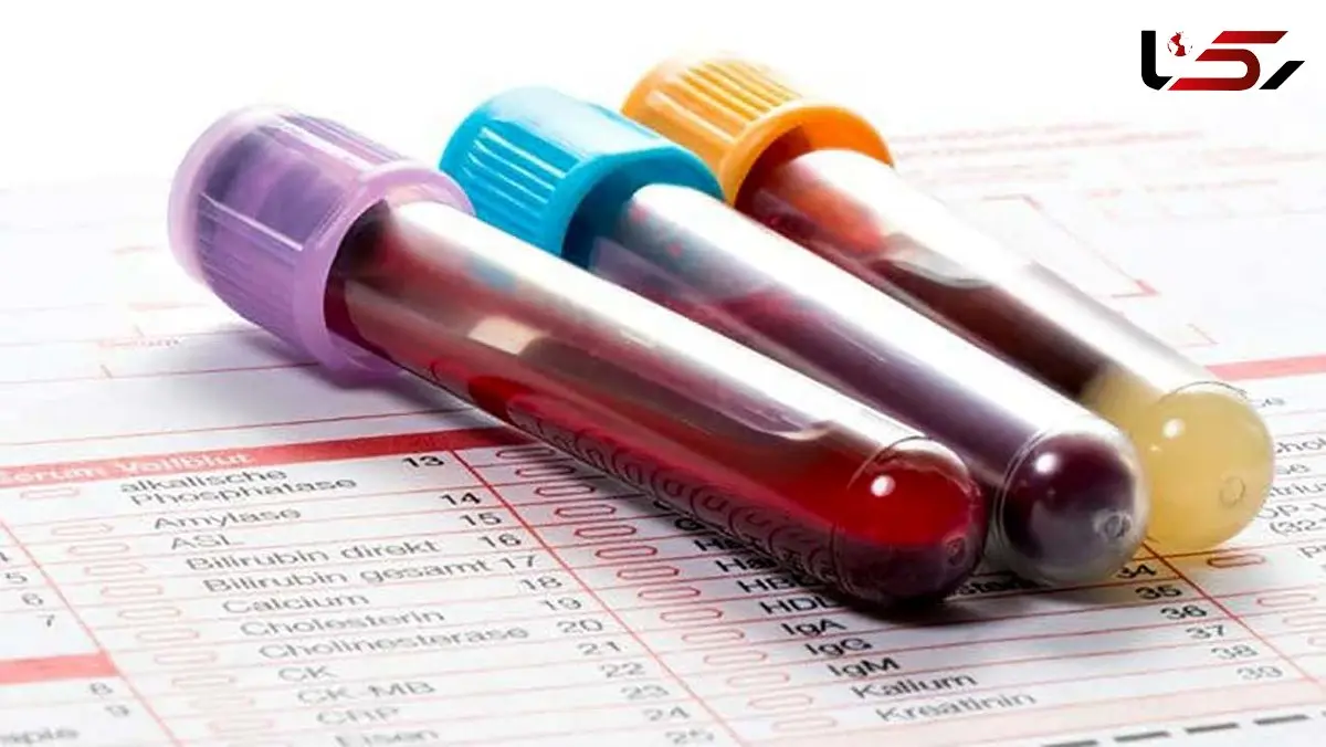 غربالگری «پویش ملی سلامت» از ۱۵ میلیون نفر گذشت