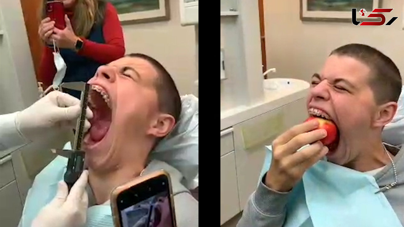 دهان گشادترین فرد در جهان کیست؟ + فیلم 