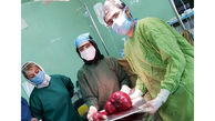 توده ای عجیب در شکم زن آذرشهری / پزشکان شوکه شدند + عکس