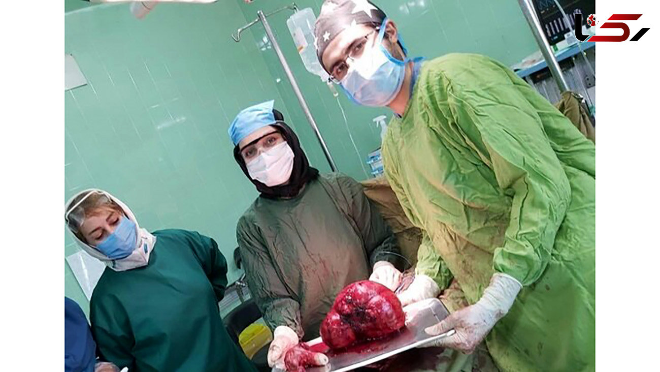توده ای عجیب در شکم زن آذرشهری / پزشکان شوکه شدند + عکس