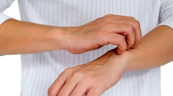 علت خارش دست و پا چیست؟ + روش ها درمان خانگی