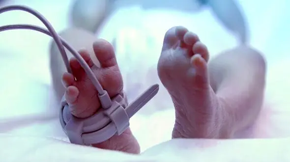 اتفاقی نادر در اتاق زایمان / نوزاد با یک جنین دیگر در شکمش متولد شد!