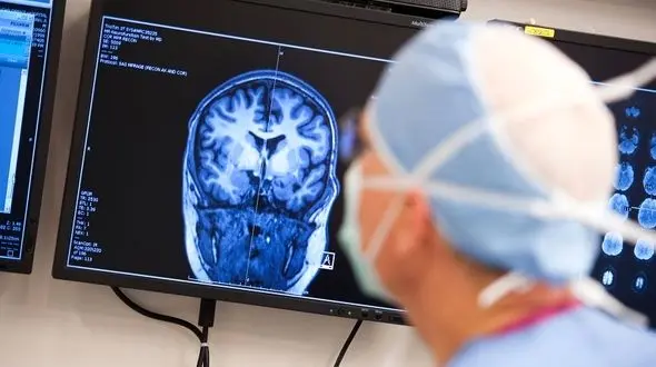 چرا بیماری صرع بین ایرانی ها شایع است؟