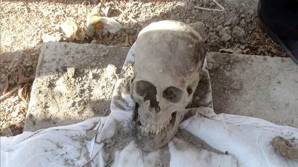 عکس /  راز جمجمه یک زن که در مشهد کشته شده است