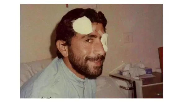 تصویر دیده نشده از جراحت سردار قاآنی در دوران دفاع مقدس  