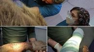 آخرین وضعیت جسمانی خرس قهوه‌ای آسیب دیده در کرمانشاه