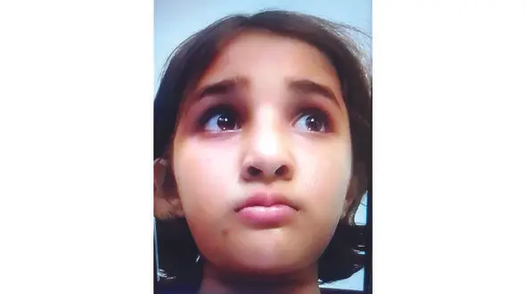 قصه دردناک مرگ دخترک اسکیت‌ سوار در مشهد ! + عکس