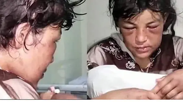 عکس هولناک / شکنجه وحشیانه زلیخای 16 ساله توسط داماد 43 ساله 