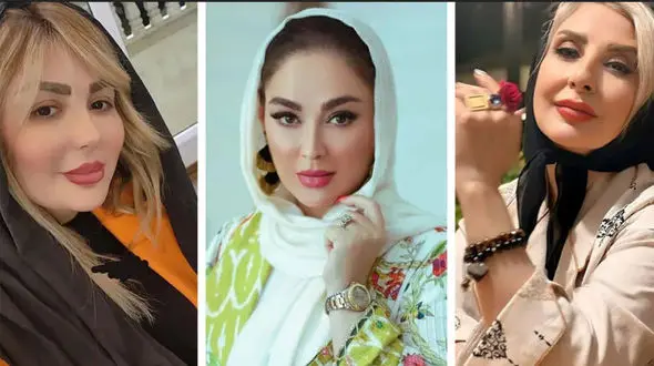 6 خانم بازیگری که با چهره شان همه را ناامید کردند + عکس ها و اسامی