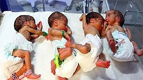 واقعیت پرونده گروگانگیری ۴ قلو‌های اهوازی