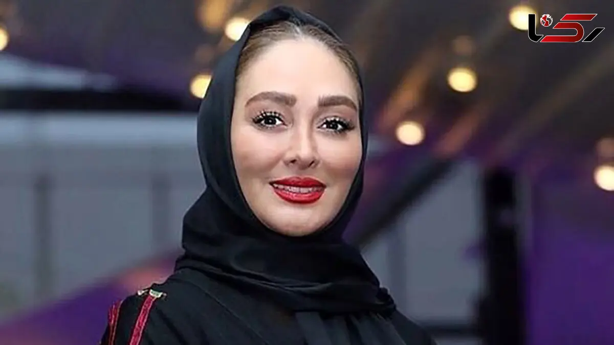 تغییر عجیب چهره الهام حمیدی ! / خانم بازیگر باز هم عمل زیبایی کرد ! + عکس