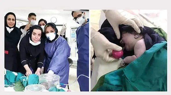 غم انگیزترین تولد یک نوزاد در بیمارستان پاکدشت / برای او گریه نکنید + عکس