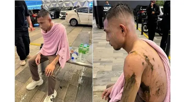 اسید پاشی هولناک روی بازیکن تیم ملی فوتبال مالزی + عکس و جزییات