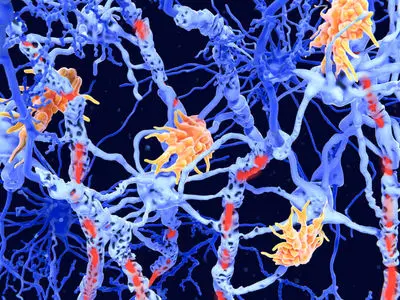 محققان 2 زیرنوع جدید از ام‌ اس را کشف کردند؛ پیشرفتی هیجان‌ انگیز