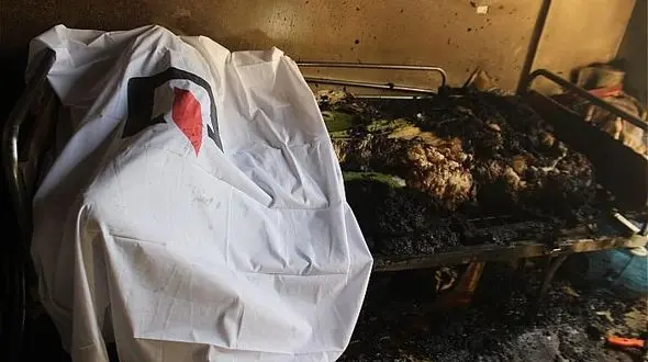 پیرمرد معلول در اتاق خوابش  زنده زنده سوخت + عکس 