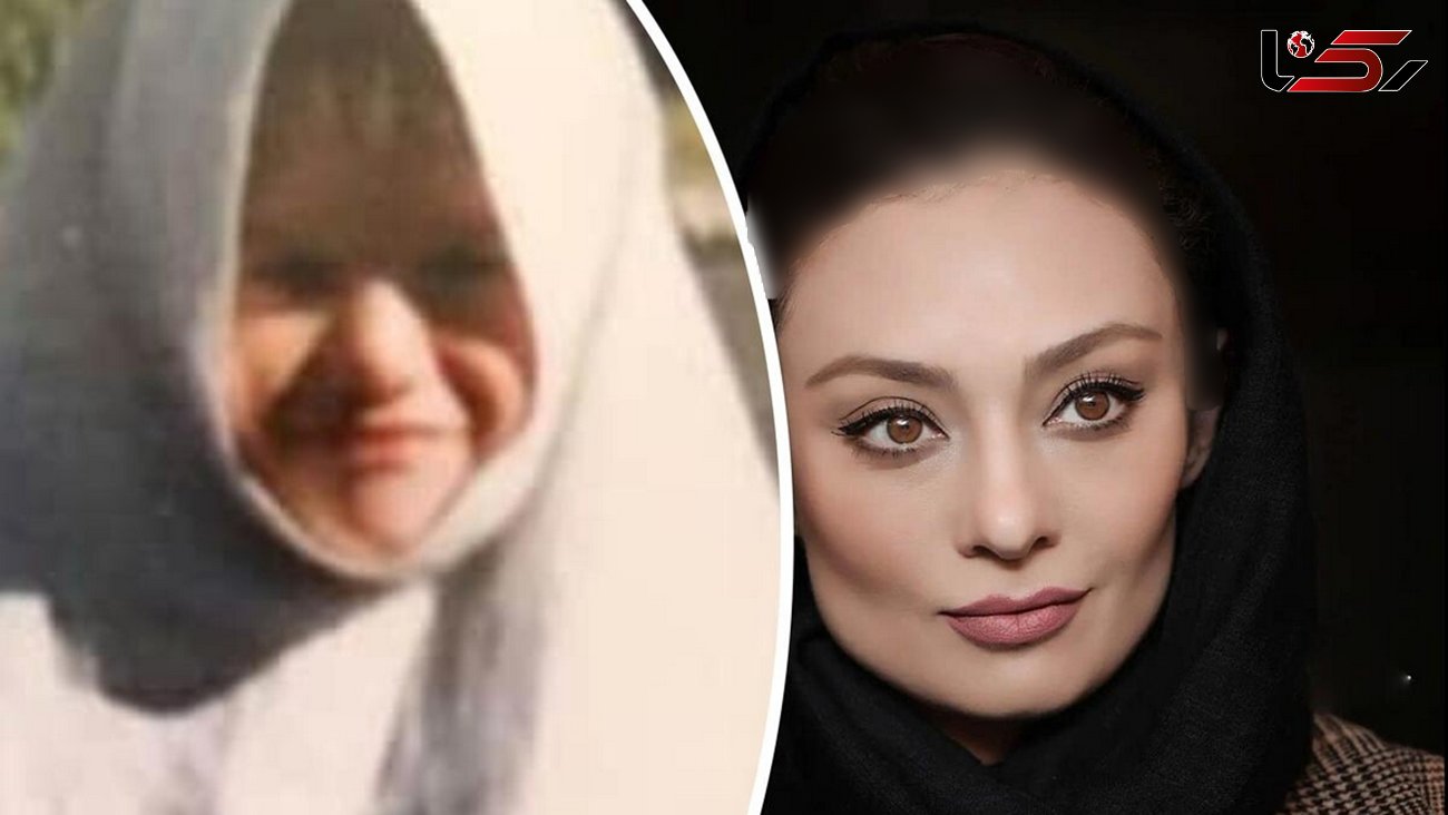 عکس های زیرخاکی از چهره معصوم خانم بازیگران ایرانی/ عمل های زیبایی آن ها را باربی کرد!+ عکس و اسامی