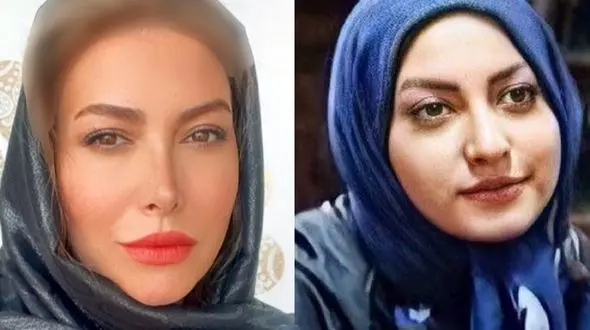 این خانم بازیگران  جراحی های عروسکی داشتند  / ایرانی ها کجاو خارجی ها کجا ؟!