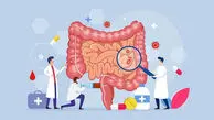 بهترین و بدترین غذاها برای سلامت روده