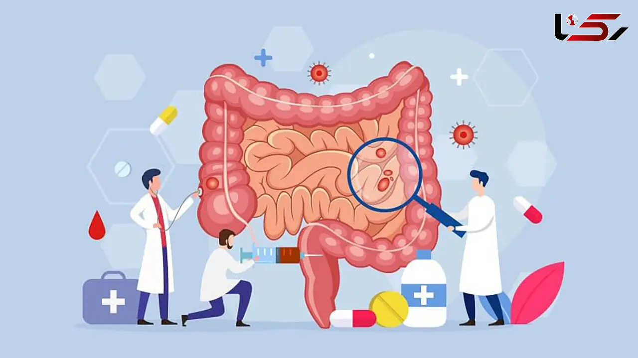 بهترین و بدترین غذاها برای سلامت روده