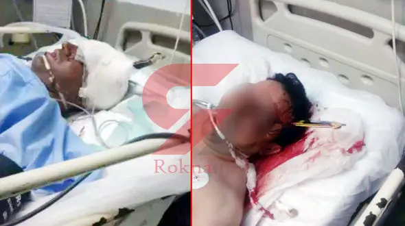 چاقو را در سر نگهبان خرمشهری در مرز شلمچه فرو کردند + عکس هولناک 14+