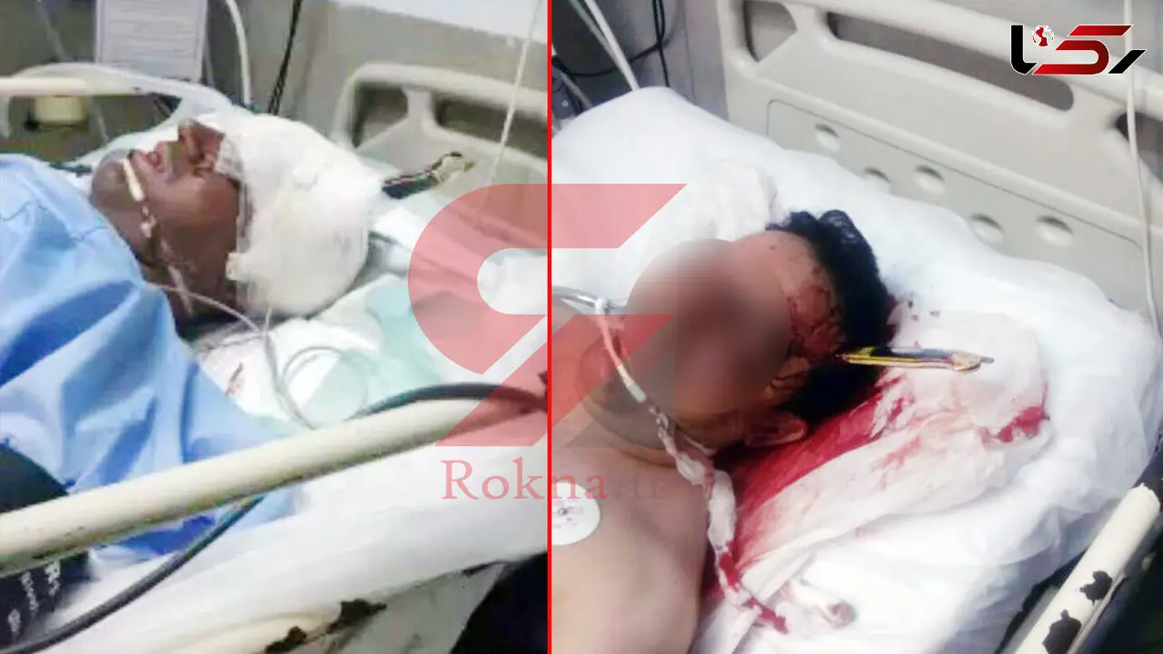 چاقو را در سر نگهبان خرمشهری در مرز شلمچه فرو کردند + عکس هولناک 14+