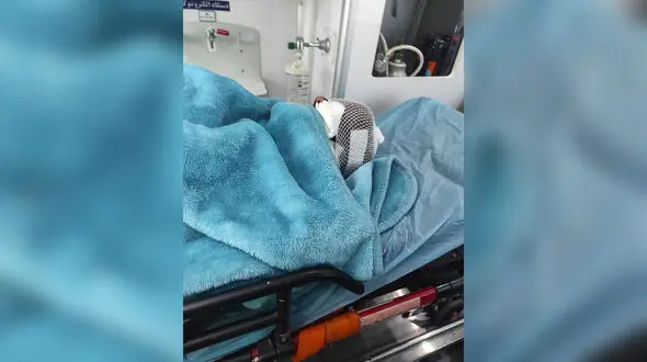 حمله خونین گرگ یا کفتار به 8 نفر در لرستان /  مرگ را به چشم خود دیدند