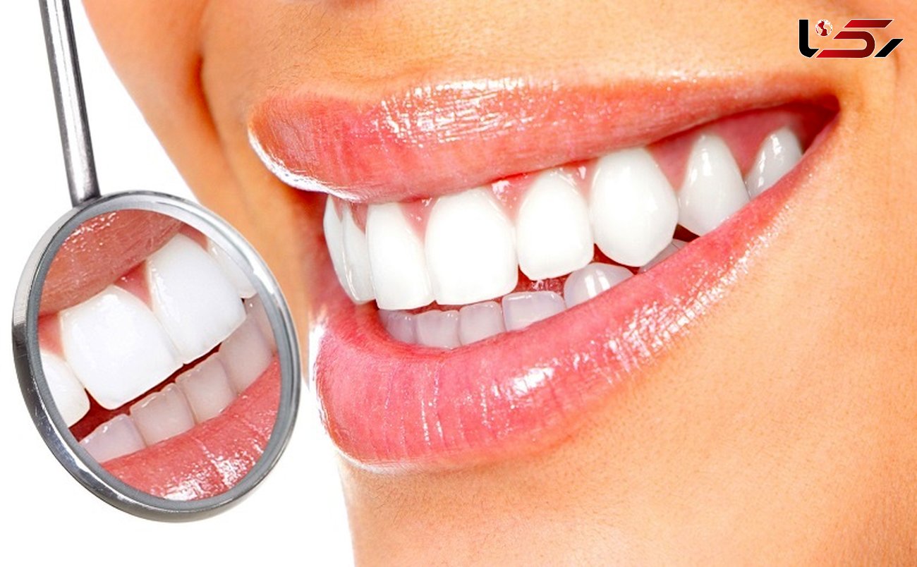 سفید کردن دندان ها با ترفندهای خانگی