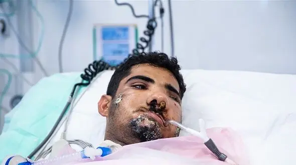 6 عکس از آبتین فرهادی تازه داماد مجروح حادثه تروریستی جیش الظلم در سیستان و بلوچستان  
