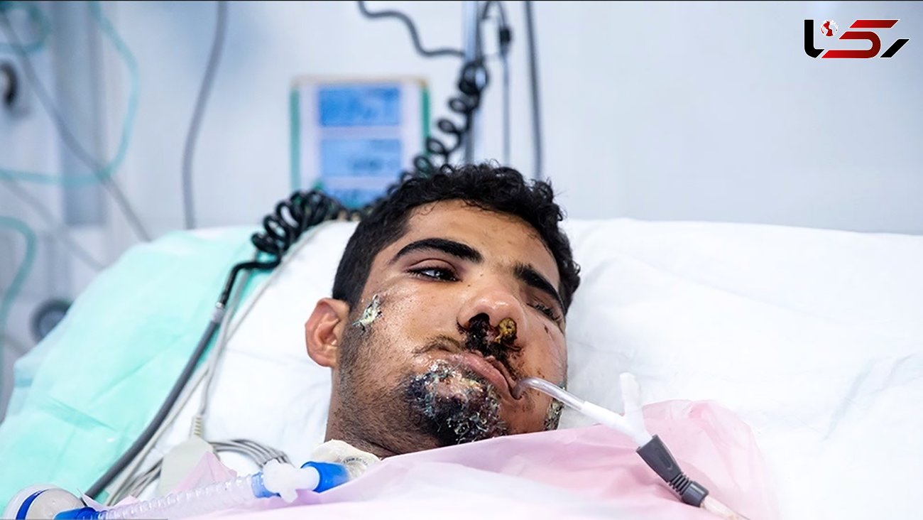 6 عکس از آبتین فرهادی تازه داماد مجروح حادثه تروریستی جیش الظلم در سیستان و بلوچستان  