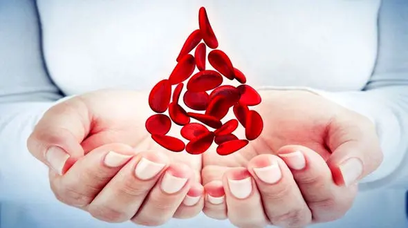 چرا 3 نفر از هر 10 زن درگیر کم‌ خونی هستند؟