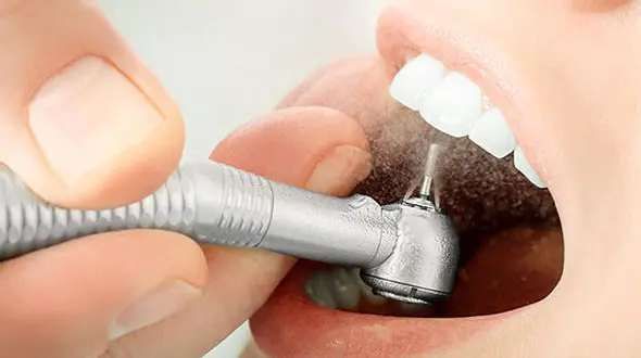 بلایی که پوسیدگی دندان سرتان می آورد