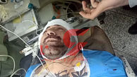 عکس محل دقیق اصابت گلوله به بدن هانی کرده + جدید ترین عکس ها  از بیمارستان 