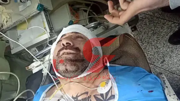عکس محل دقیق اصابت گلوله به بدن هانی کرده + جدید ترین عکس ها  از بیمارستان 