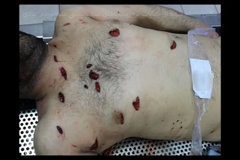 تروریست‌ها هیچ رحمی به مردم عادی نکردند