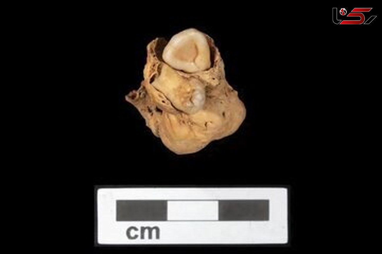 کشف گنج عجیب در دهان جسد زن 3 هزار ساله + عکس