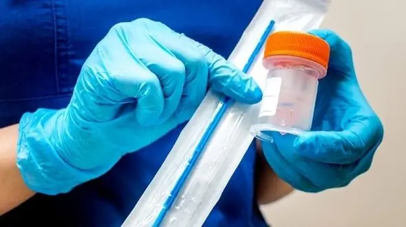 ویروسی مرگبار با طول عمر بالا در کمین زنان / برای پیشگیری دختران از 12 سالگی واکسن بزنند