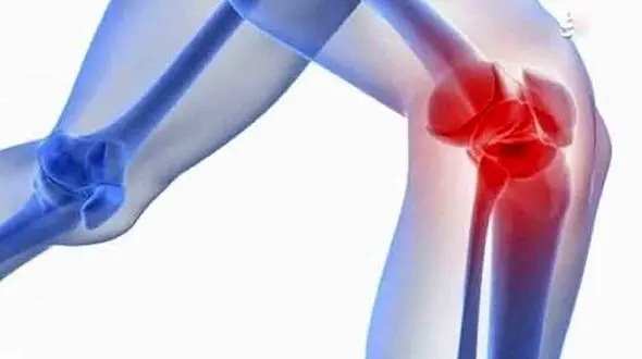 خطر زانو درد با مصرف ماست و دوغ ترش 