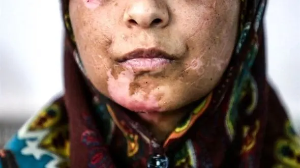 30 سال زندان برای شوهر بی رحم اعظم+عکس