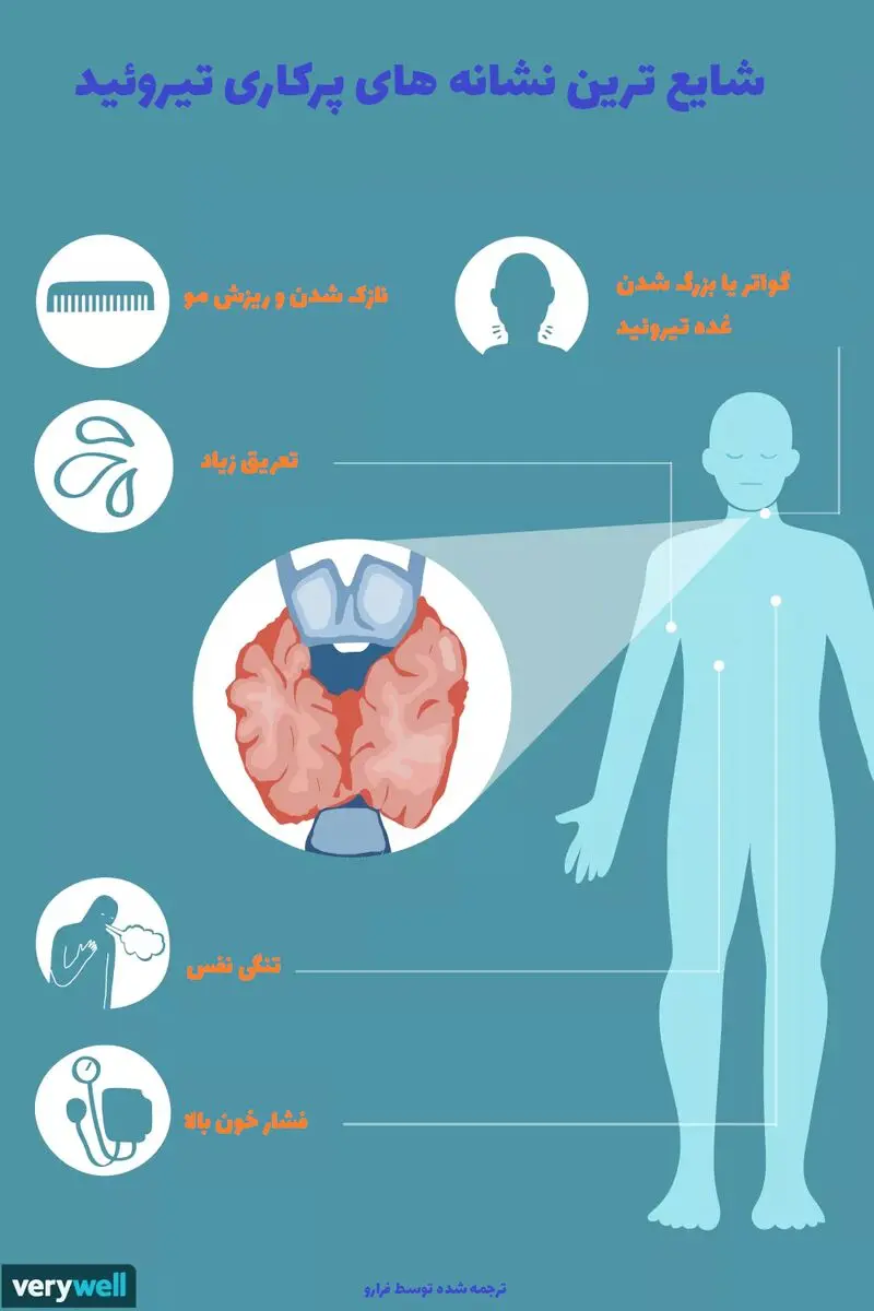 ۱۲ دلیلی که باعث شکست رژیم لاغری شما می‌شود