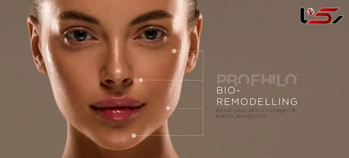 هزینه تزریق پروفایلو