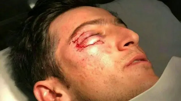 سردار آزمون راهی بیمارستان شد + عکس