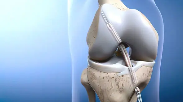 acl چیست؟ / جدول های مهم و تخصصی 