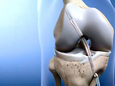 acl چیست؟ / جدول های مهم و تخصصی 