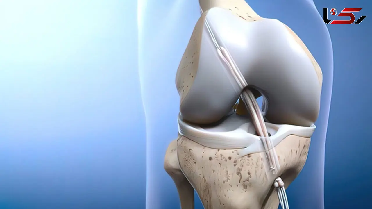 acl چیست؟ / جدول های مهم و تخصصی 