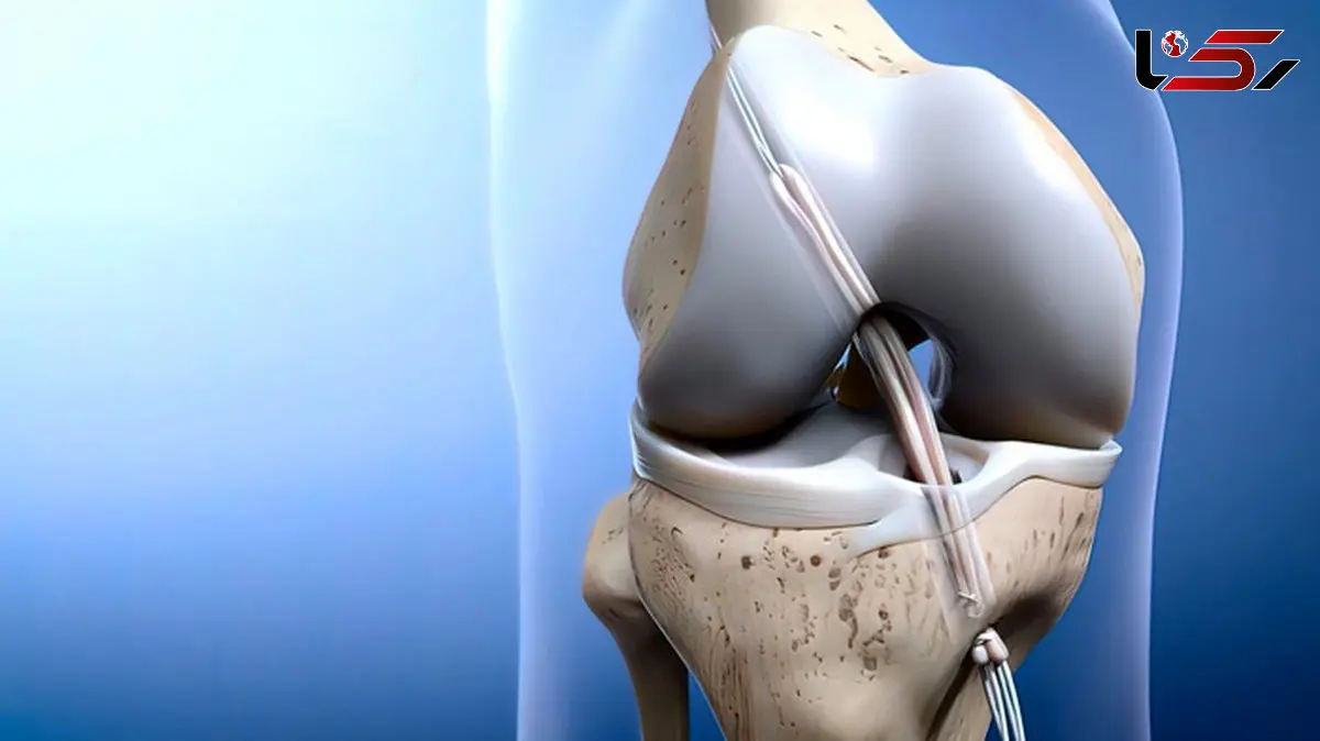 acl چیست؟ / جدول های مهم و تخصصی