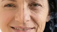 چرا افراد سیگاری چین و چروک پوست بیشتری دارند؟