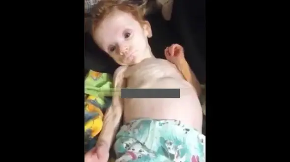 مادر این پسربچه 6 ماه او را در کمد خانه زندانی کرده بود +فیلم و عکس