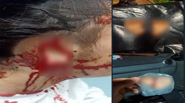 بریدن گوش‌های دختر 15 ساله در بهشهر /  واکنش ها به این جنایت وحشیانه + عکس های گوش های بریده و متهم