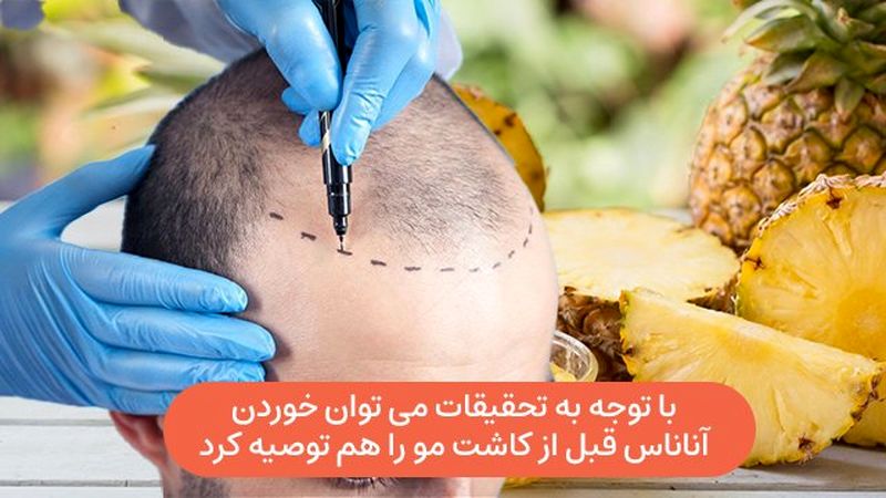 با توجه به تحقیقات می‌توان خوردن آناناس قبل از کاشت مو را هم توصیه کرد