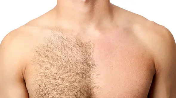 حقایق جالب درباره موهای بدن